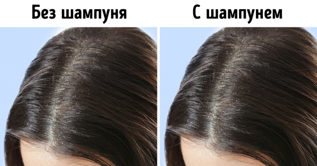 7 продуктів, з за яких волосся втрачають блиск, випадає